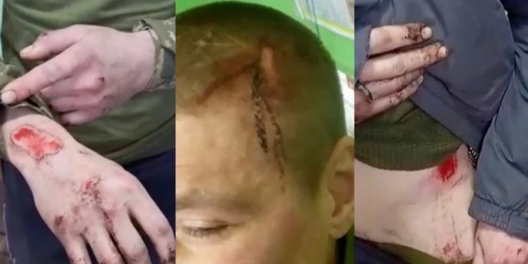 Військовий оглядач Василь Пехньо пояснює підозри колишньому командиру 155-ї бригади та проблеми штурмових полків.